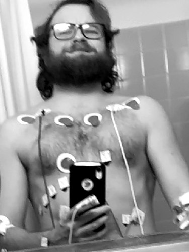 Miller in a hospital mirror with heart monitor leads on his chest